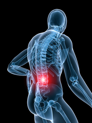 Spondylitis