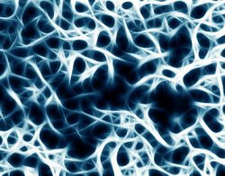 Osteoporose Schwächung der Knochen durch Knochenschwund