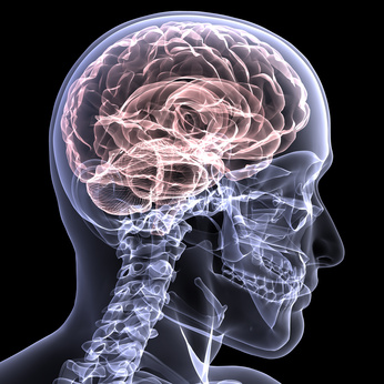 Parkinson Parkinson