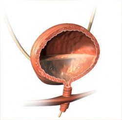 Blasenentzündung Therapien gegen Blasenentzündung