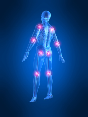 Arthrose