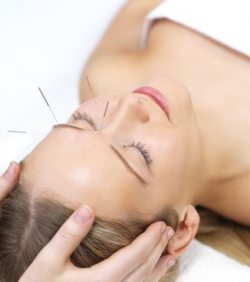 Akupunktur Heilung und Linderung durch Akupunktur