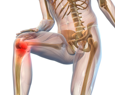 Arthrose Arthrose