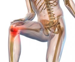 Arthrose Arthrosebehandlung mit Kneipp