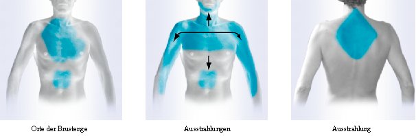 ausstrahlungen