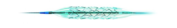 stent